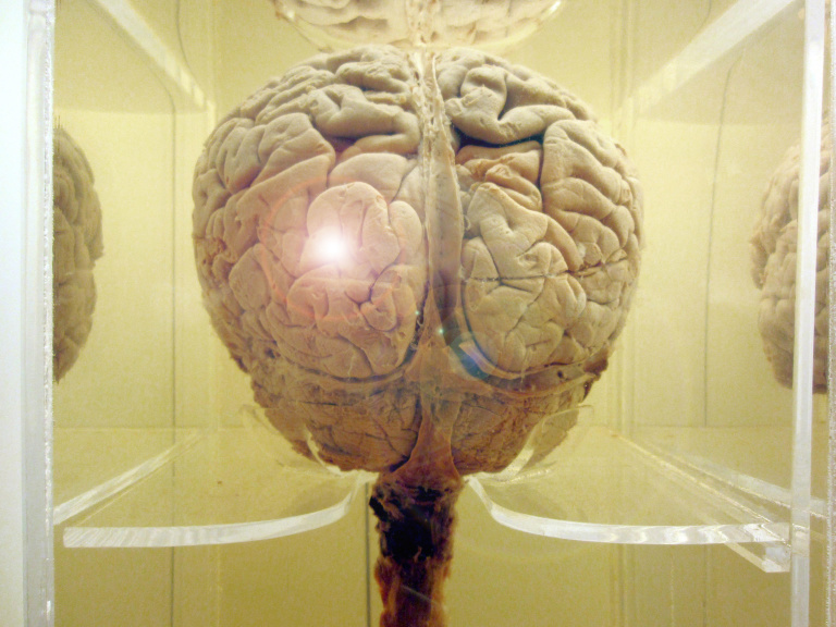 Lack of mental health parity creates ‘walking wounded’