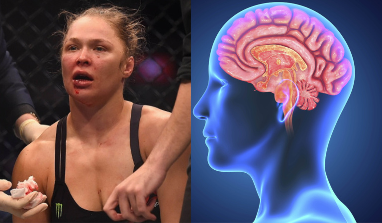CTE, the UFC and the dark side of combat sports