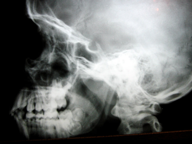 Letter: Death by asphyxiation immoral, inhumane