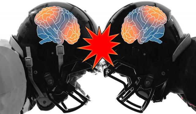 concussion
