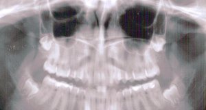 Three companies receive Medicaid managed care dental contracts dental contracts