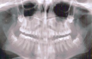 Three companies receive Medicaid managed care dental contracts dental contracts