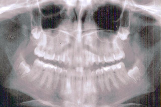 dental contracts