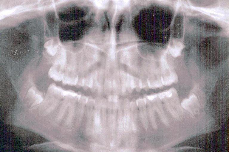 Three companies receive Medicaid managed care dental contracts